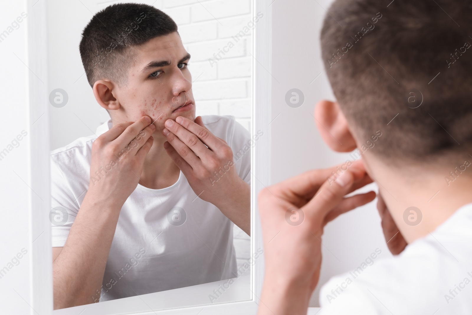 Photo of Upset young man looking at mirror and touching pimple on his face indoors. Acne problem