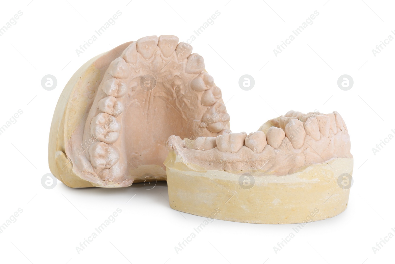 Photo of Dental model with jaws isolated on white. Cast of teeth