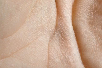 Closeup view of human hand with dry skin