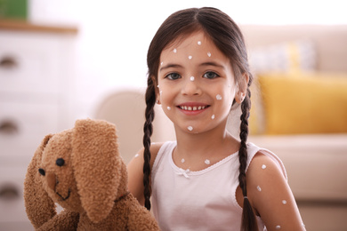 Photo of Little girl with chickenpox playing at home
