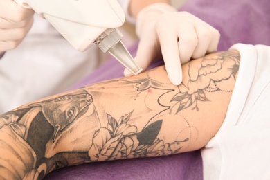 Photo of Young woman undergoing laser tattoo removal procedure in salon, closeup