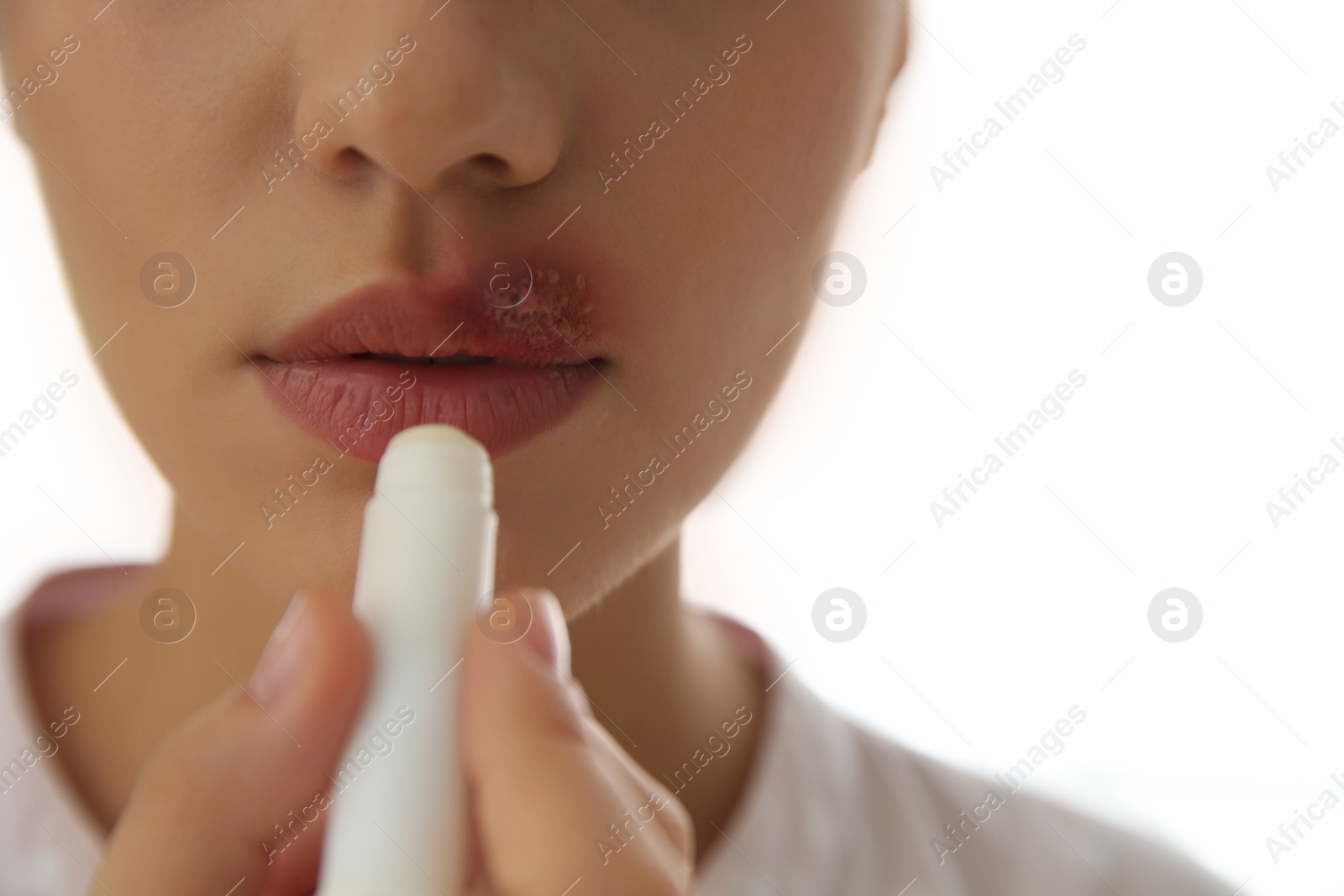 Photo of Woman with herpes applying lip balm against light background, closeup