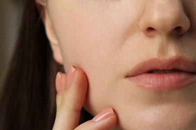 Macro view of woman with dry skin