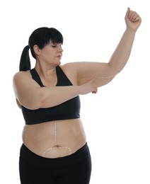 Photo of Obese woman with marks on body against white background. Weight loss surgery