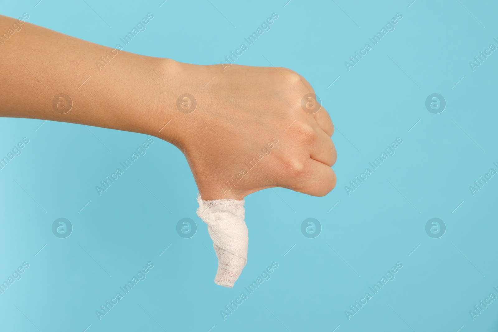 Photo of Woman showing thumb down wrapped in medical bandage on light blue background, closeup