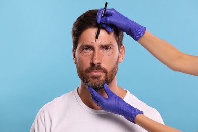 Doctor drawing marks on man's face for cosmetic surgery operation against light blue background