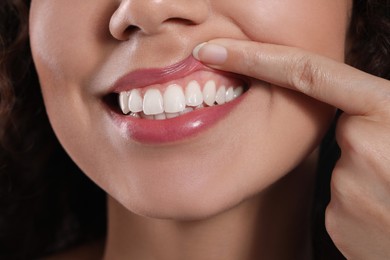 Photo of Young woman showing healthy gums, closeup view