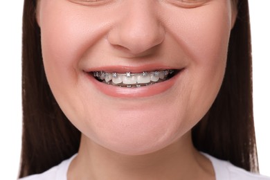 Smiling woman with dental braces on white background, closeup