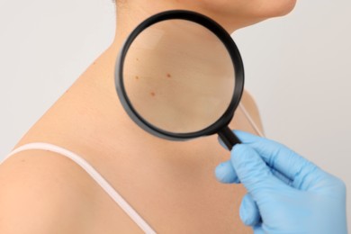 Dermatologist examining patient's birthmark with magnifying glass on beige background, closeup