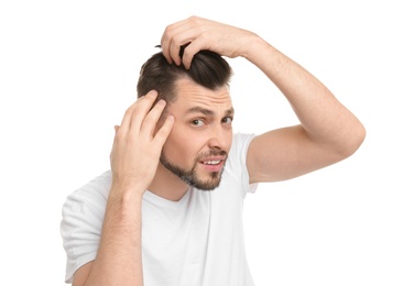 Young man with hair loss problem on white background