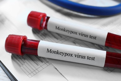 Photo of Monkeypox virus test. Sample tubes with blood on medical forms, closeup