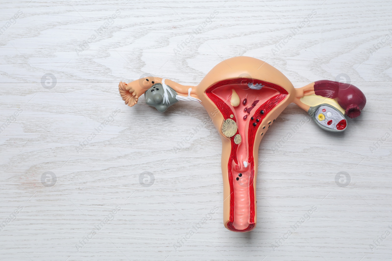 Photo of Anatomical model of uterus on white wooden table, top view with space for text. Gynecology concept