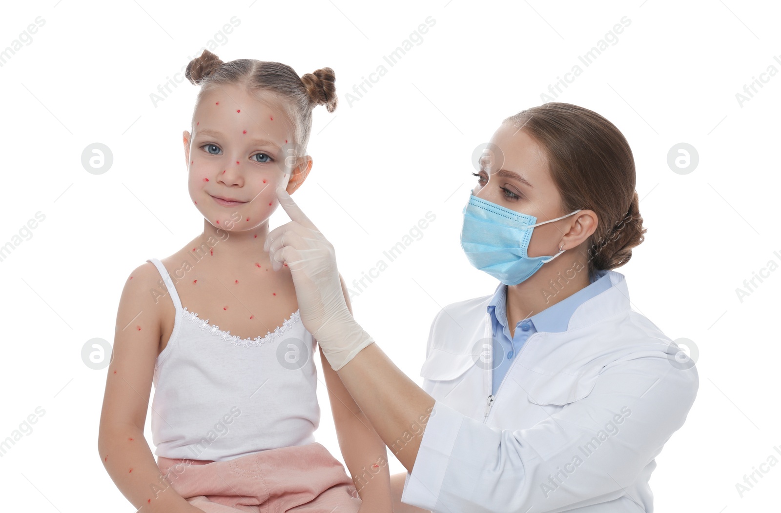 Photo of Doctor examining little girl with chickenpox on white background. Varicella zoster virus