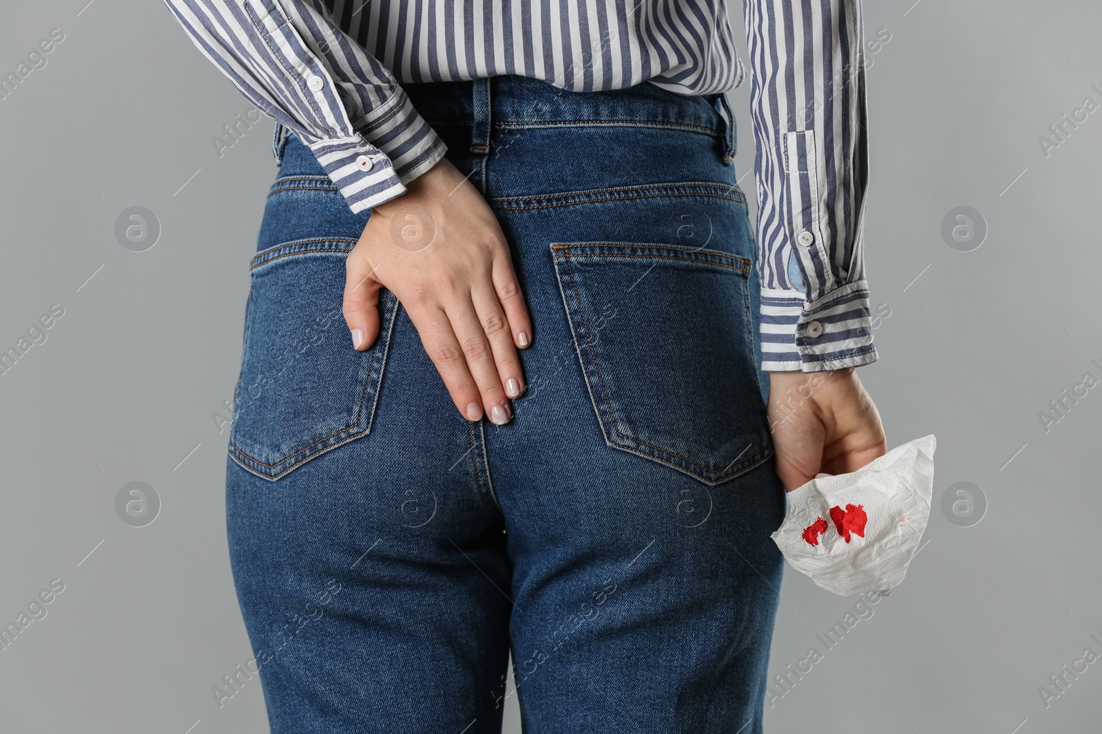 Photo of Woman holding toilet paper with blood stain on light grey background, closeup. Hemorrhoid concept