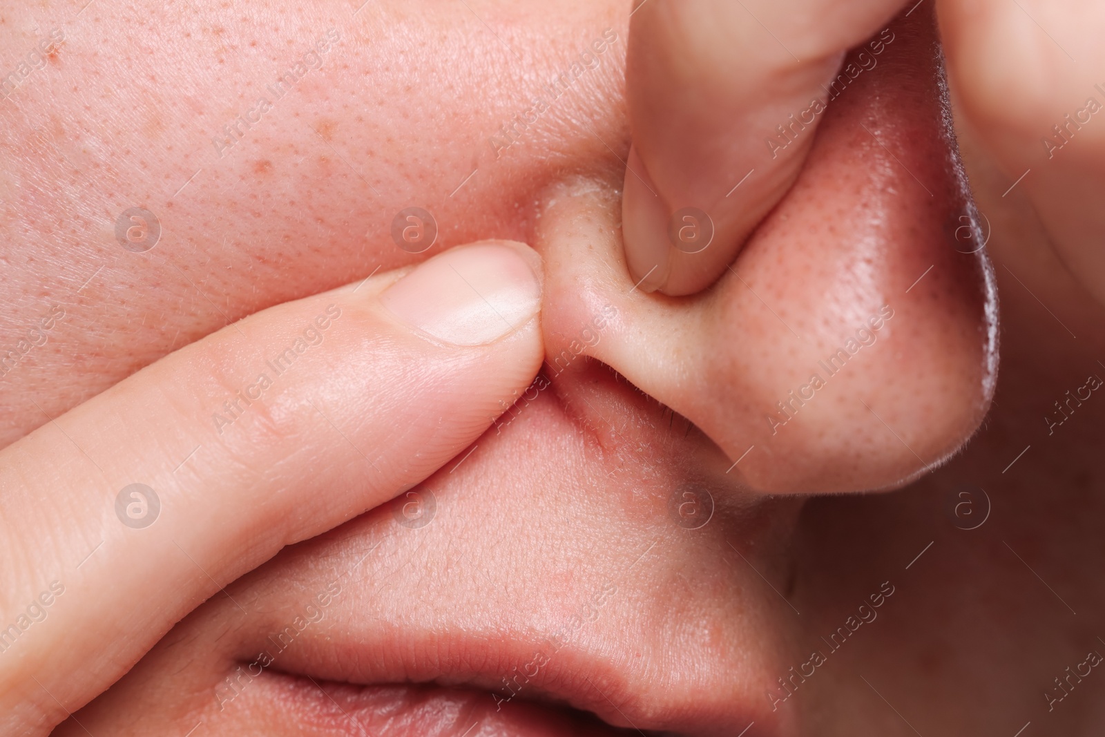 Photo of Woman popping pimple on her nose, closeup