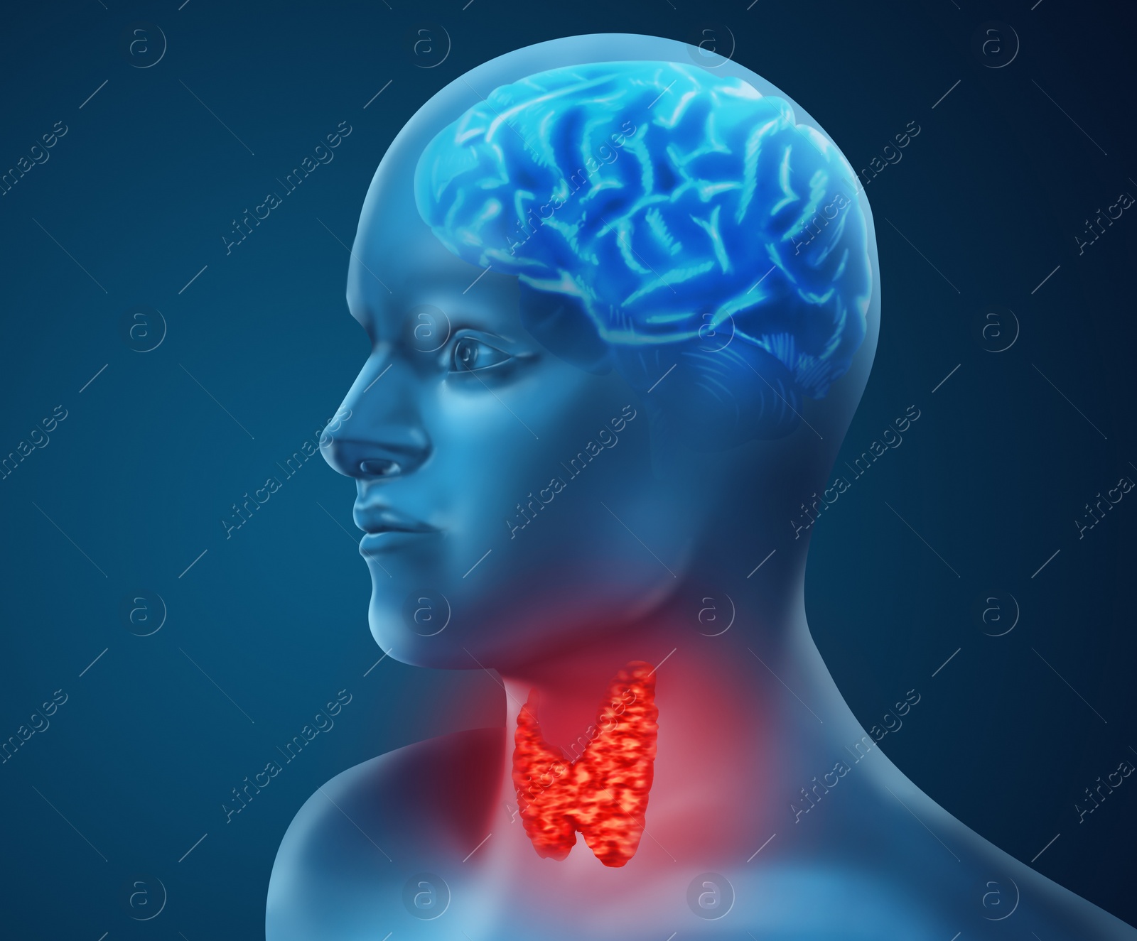 Illustration of  human with inflamed thyroid gland on color background