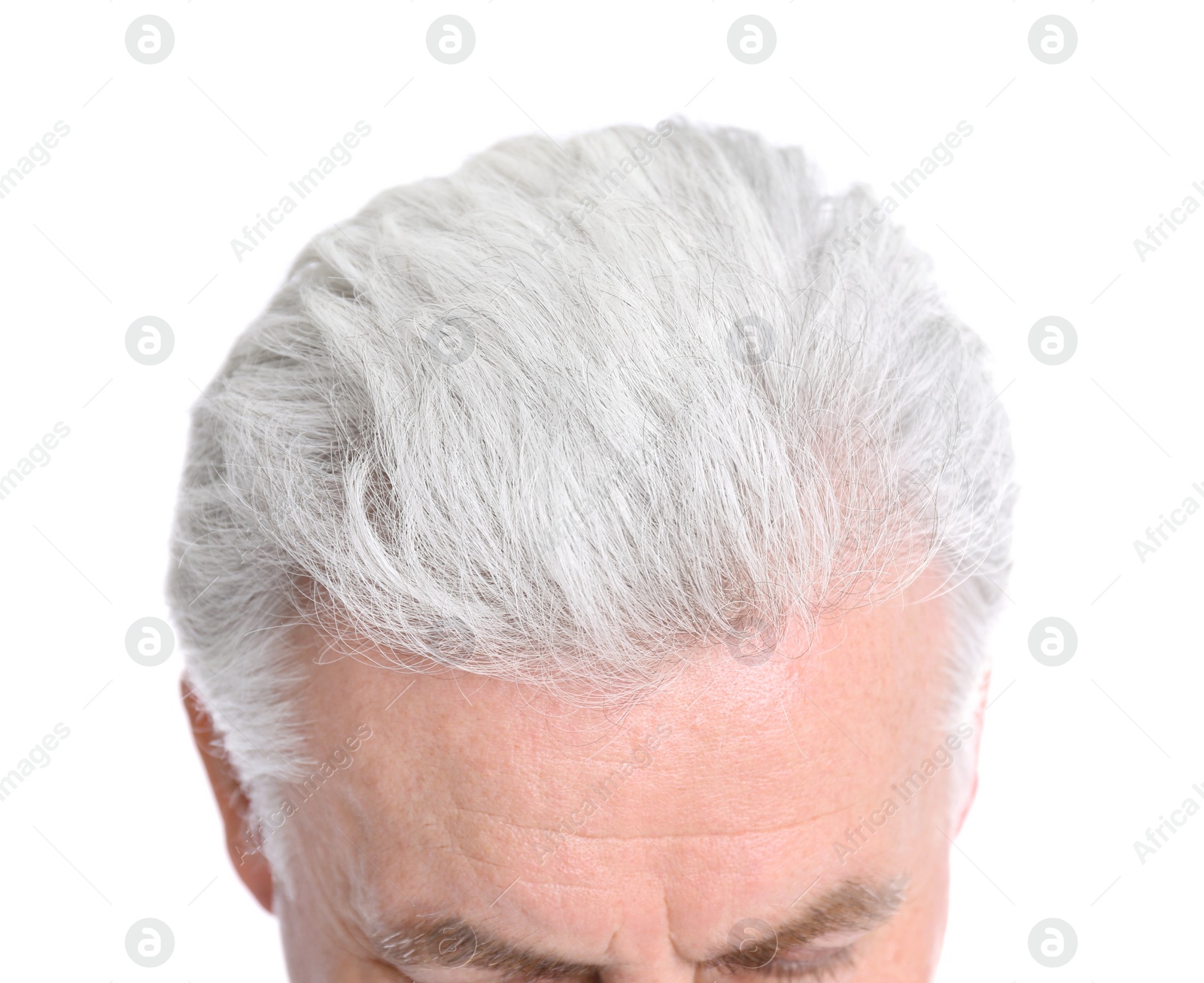 Photo of Senior man with hair loss problem isolated on white, closeup