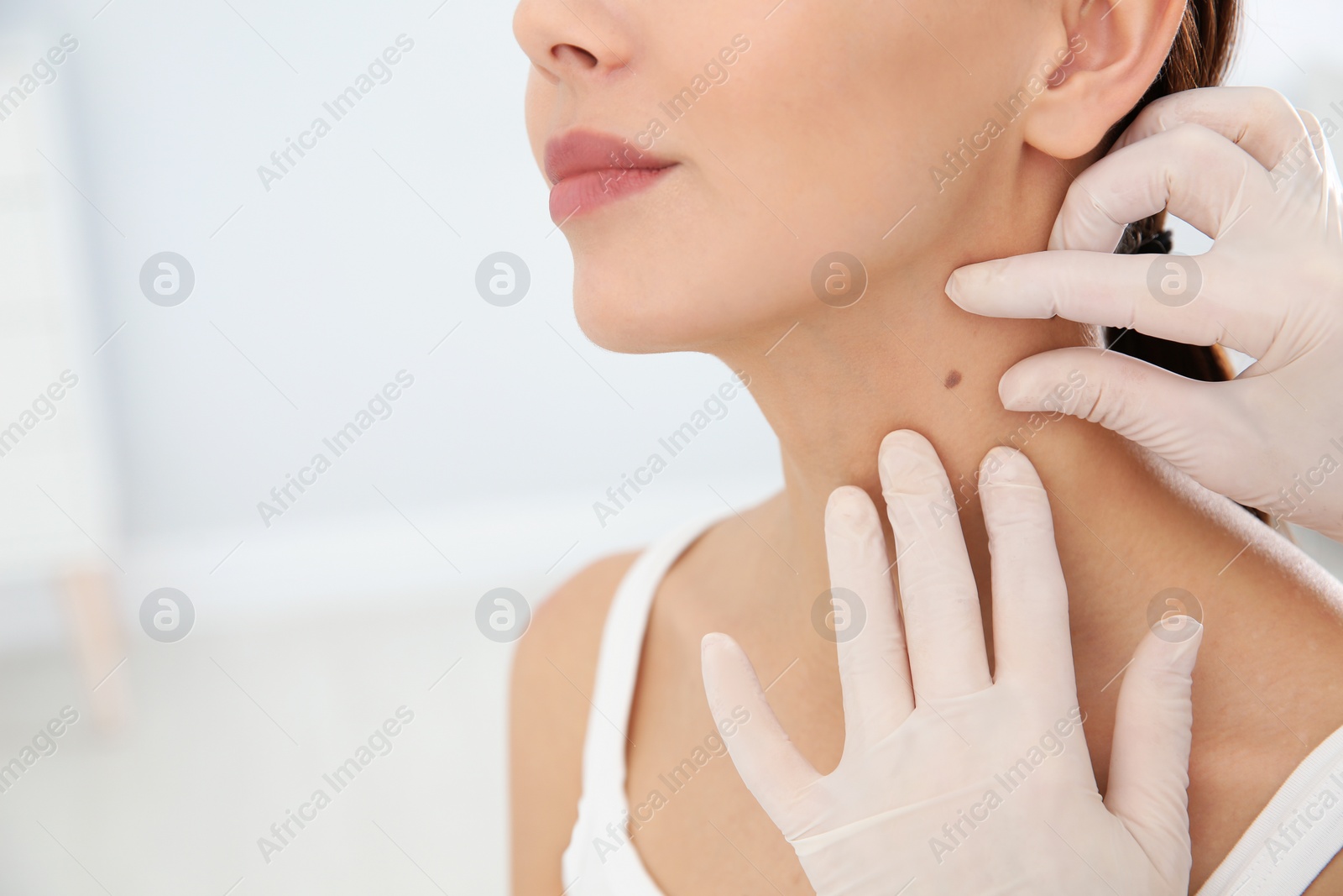 Photo of Dermatologist examining patient's birthmark in clinic, closeup. Space for text