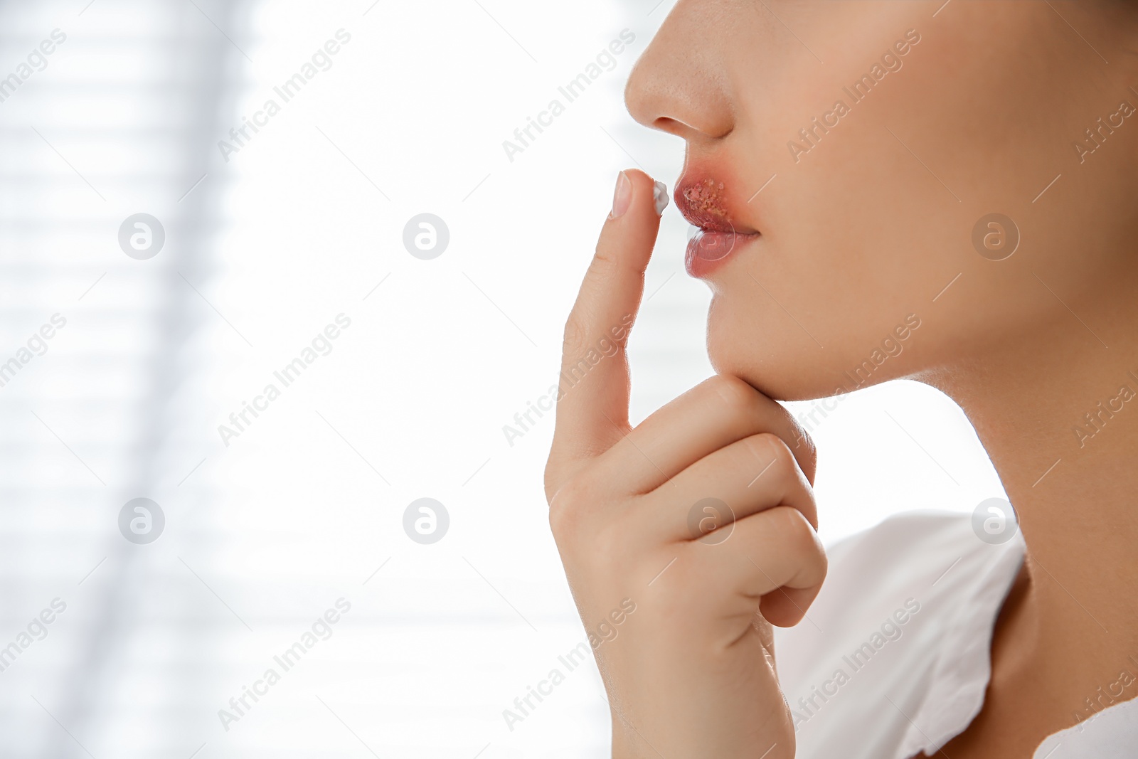 Photo of Woman with herpes applying cream on lips against light background, closeup. Space for text