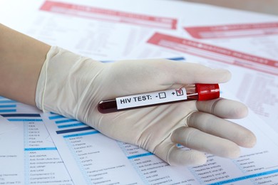 Photo of Scientist holding tube with blood sample and label HIV Test against laboratory forms, closeup