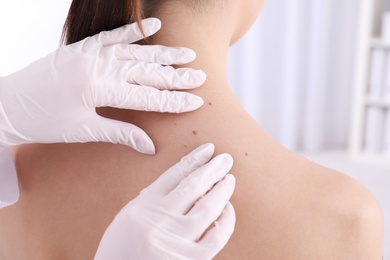 Photo of Dermatologist examining patient in clinic, closeup view