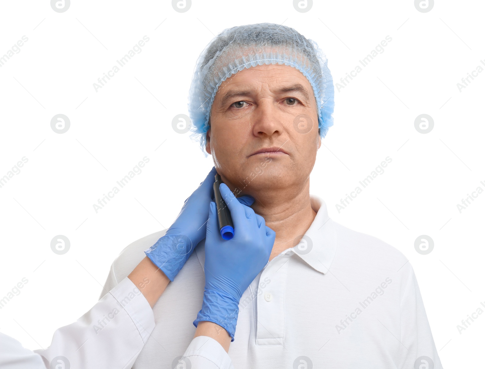 Photo of Surgeon with marker preparing man for operation against white background. Double chin removal