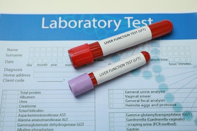 Photo of Liver Function Test. Tubes with blood samples and form on table, above view
