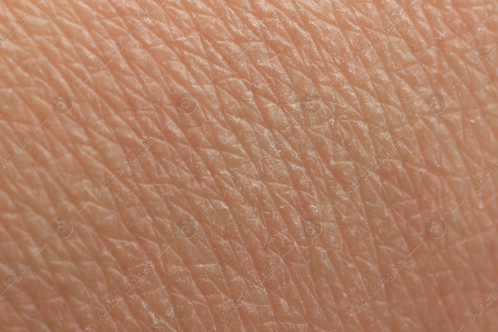 Photo of Texture of dry skin as background, macro view