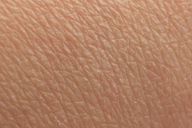 Photo of Texture of dry skin as background, macro view