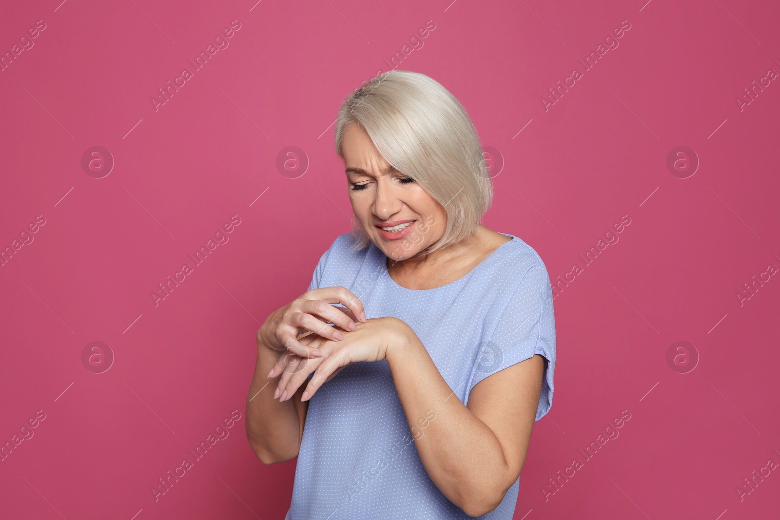 Photo of Mature woman scratching hand on color background. Annoying itch