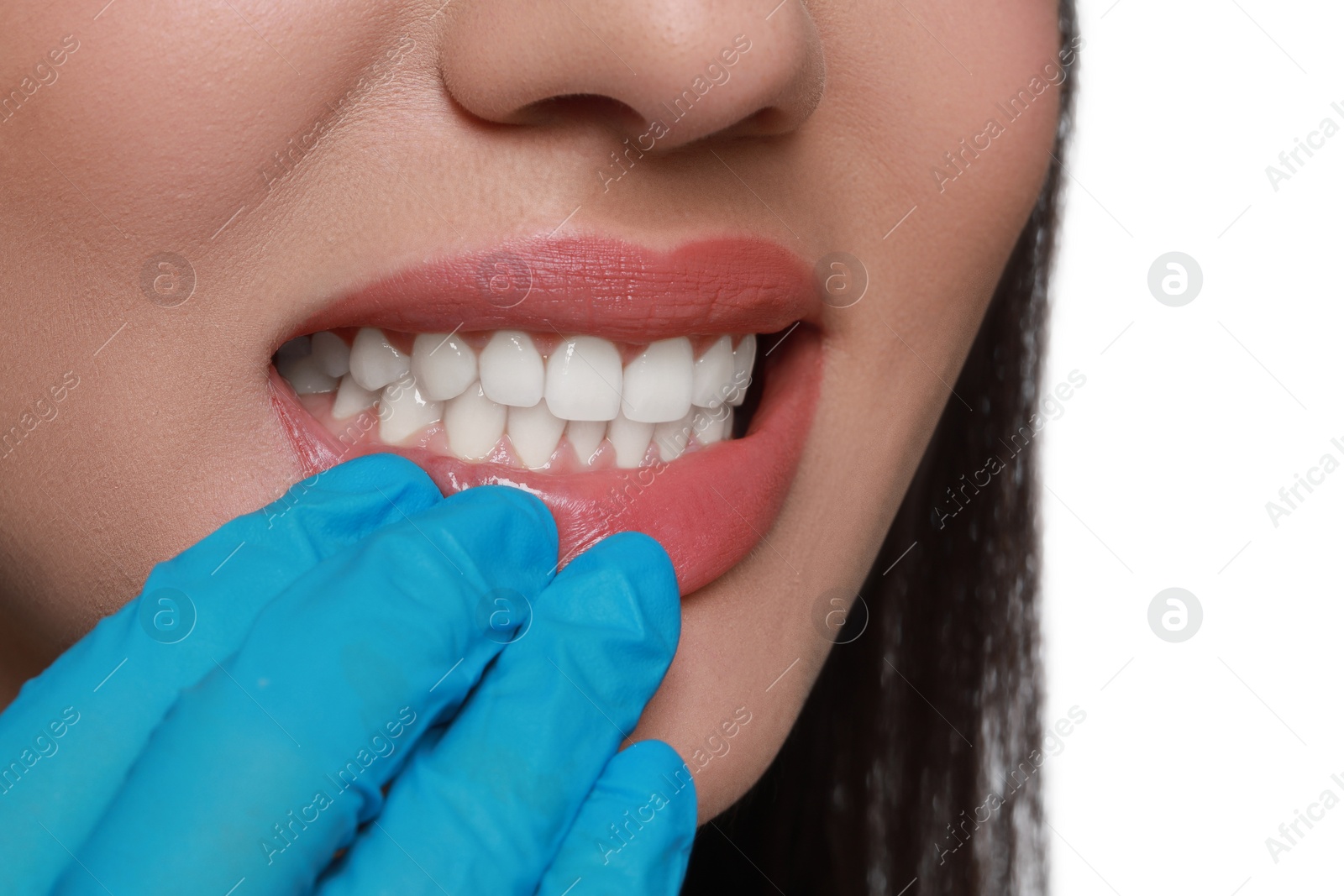 Photo of Doctor examining woman's gums on white background, closeup