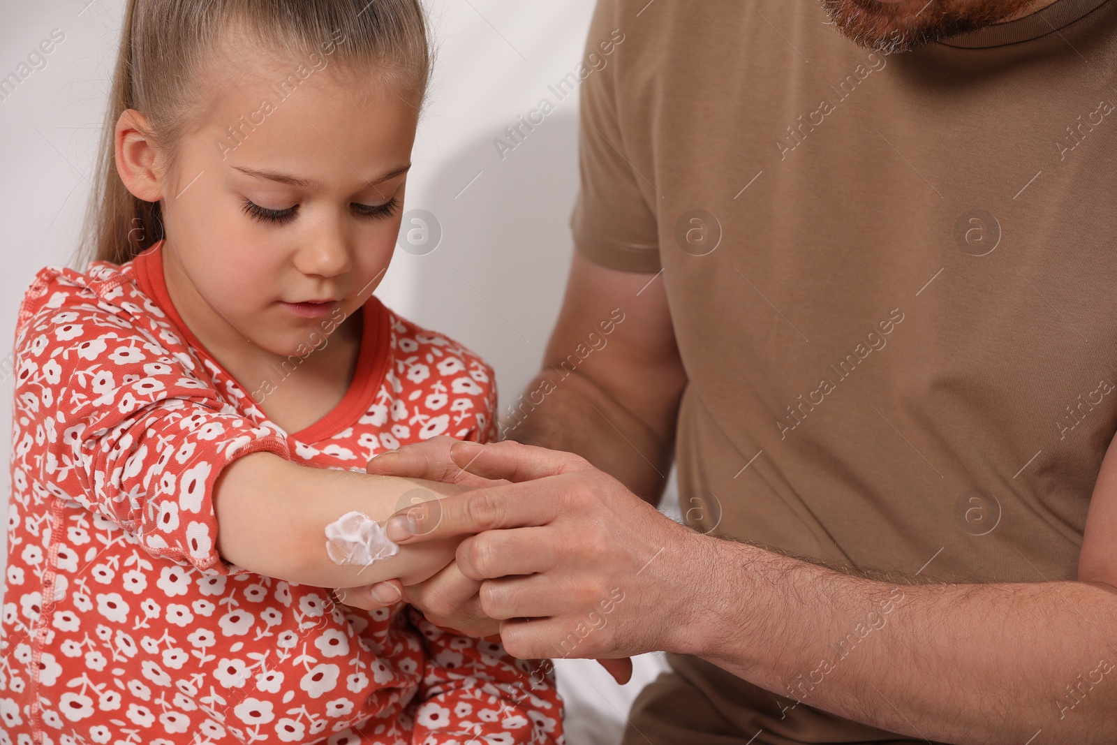 Photo of Father applying ointment onto his daughter's elbow