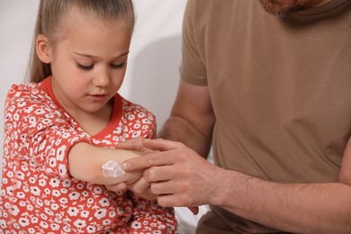 Photo of Father applying ointment onto his daughter's elbow