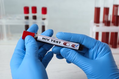 Photo of Scientist holding tube with blood sample and label HIV Test at white table, closeup