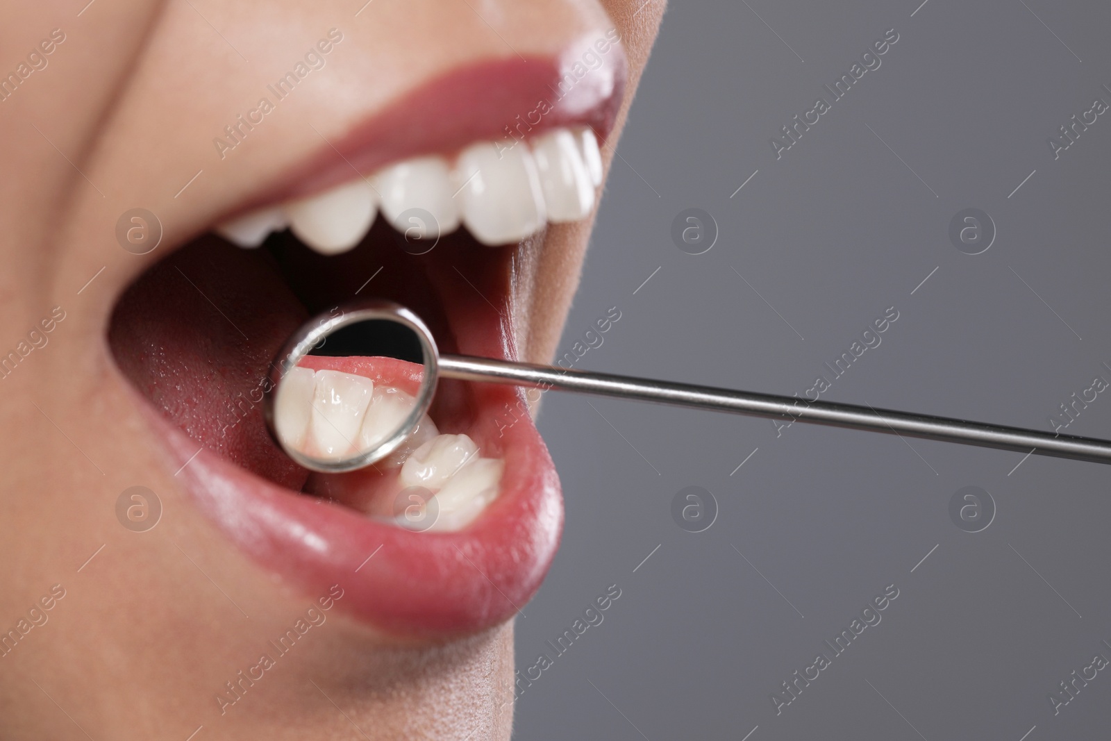 Photo of Examining woman's teeth with dentist's mirror on grey background, closeup