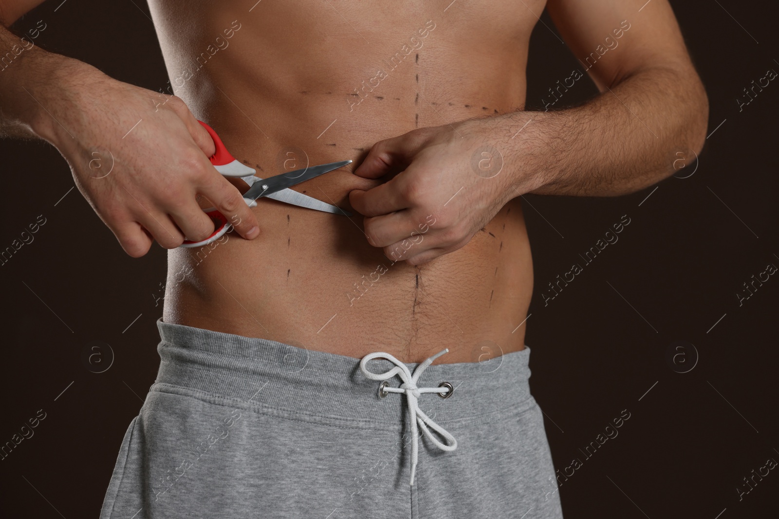 Photo of Fit man with scissors and marks on body against dark brown background, closeup. Weight loss surgery