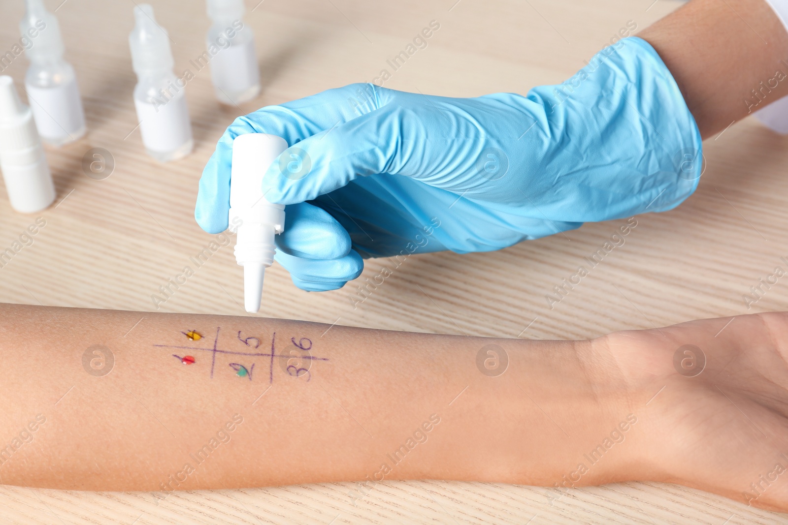 Photo of Doctor making allergy test at table, closeup