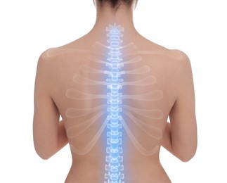 Image of Woman with healthy spine on white background, back view