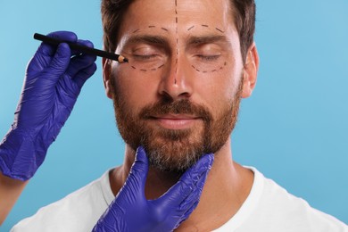 Doctor drawing marks on man's face for cosmetic surgery operation against light blue background