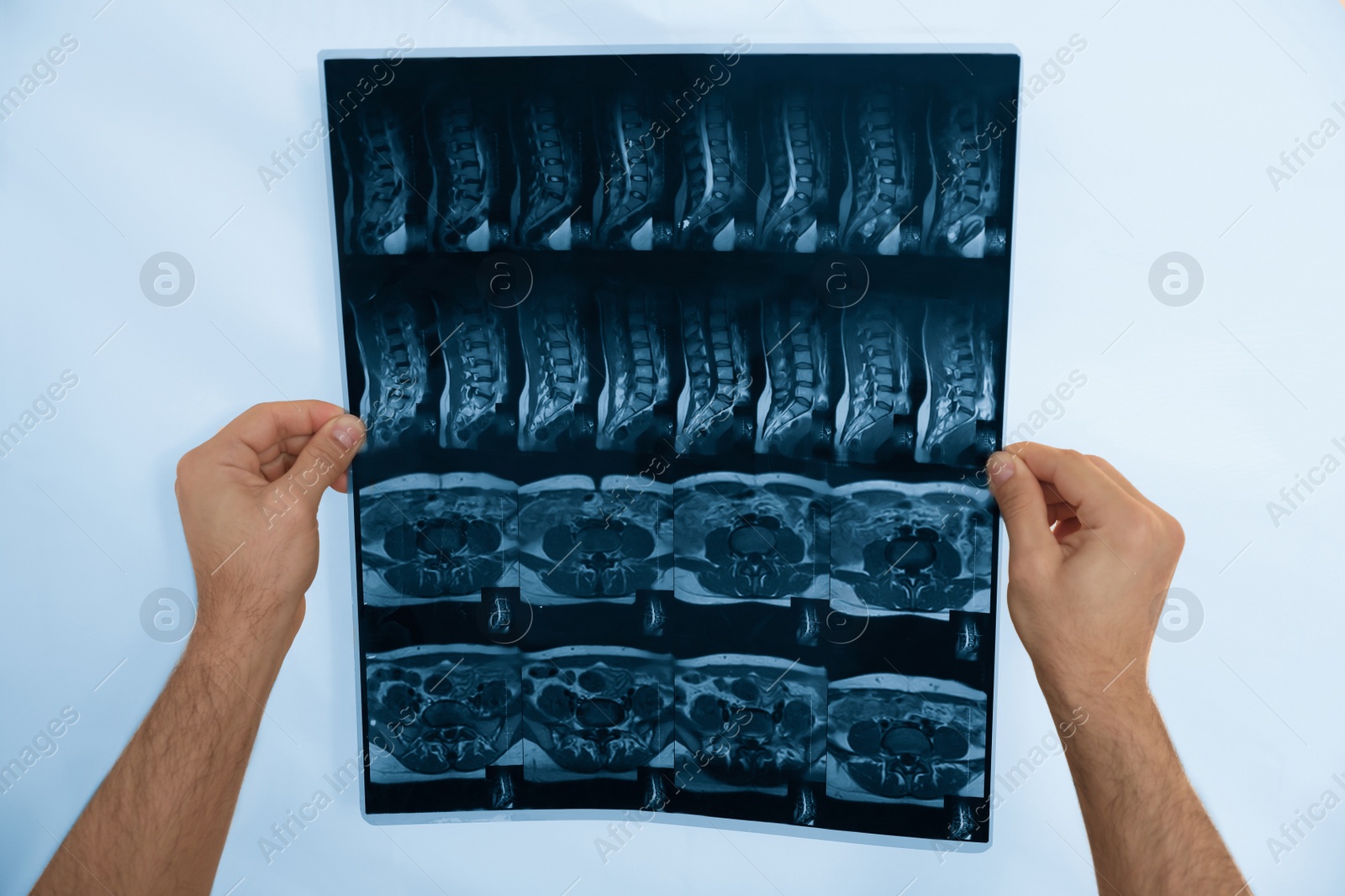 Photo of Orthopedist examining X-ray picture on viewing screen, closeup