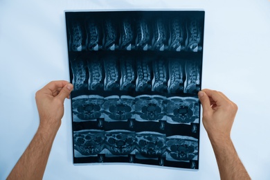 Photo of Orthopedist examining X-ray picture on viewing screen, closeup