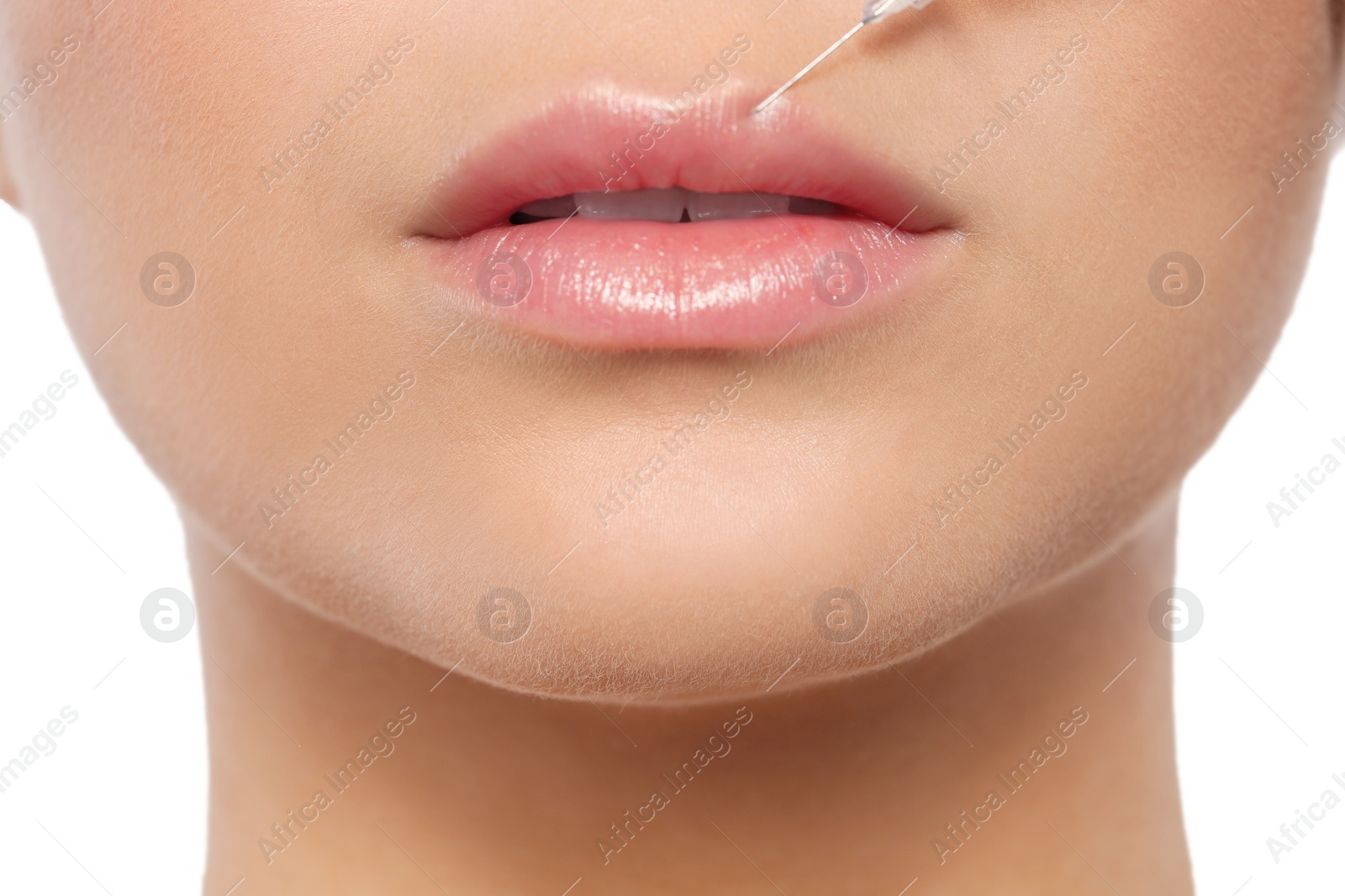 Photo of Young woman getting lips injection on white background, closeup. Cosmetic surgery