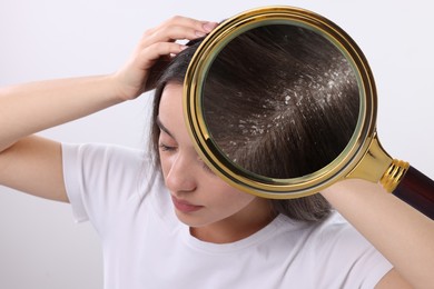 Woman suffering from dandruff on light background. View through magnifying glass on hair with flakes