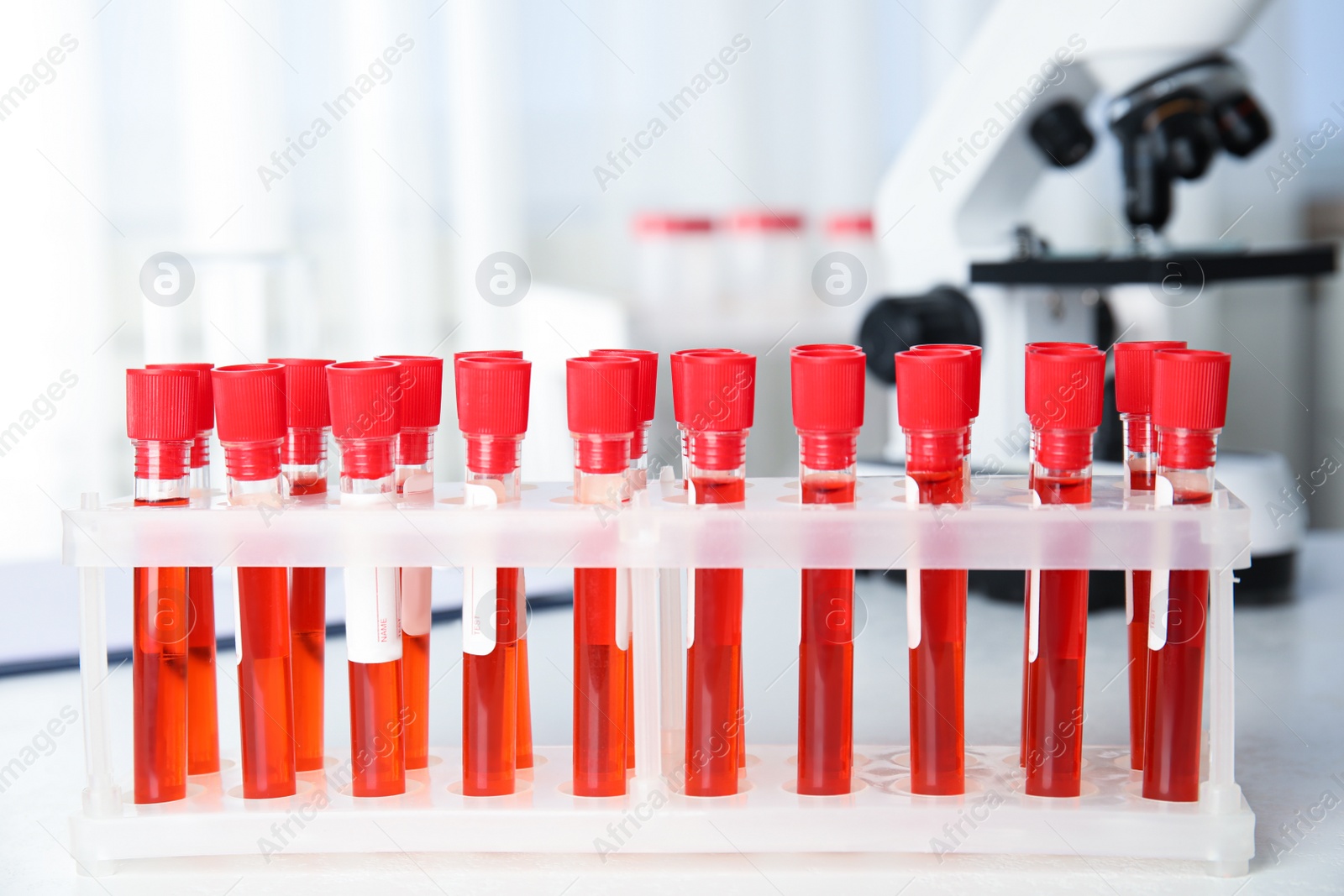 Photo of Test tubes with blood samples on table in laboratory. Virus research