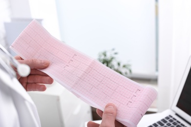 Photo of Doctor examining cardiogram in medical clinic, closeup