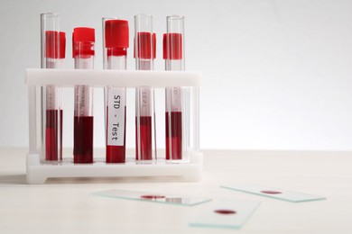 Photo of Tubes with blood samples in rack and glass slides on white table, space for text. STD test