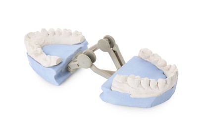 Photo of Dental model with gums isolated on white. Cast of teeth