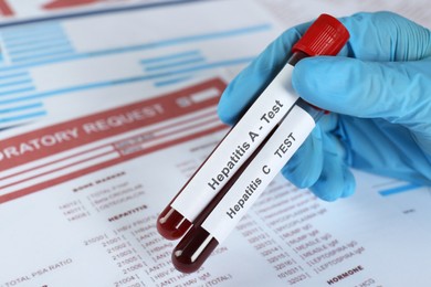 Scientist holding tubes with blood samples for hepatitis virus test against laboratory forms, closeup