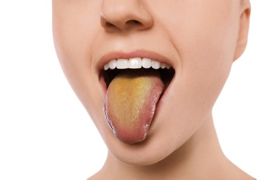 Photo of Gastrointestinal diseases. Woman showing her yellow tongue on white background, closeup