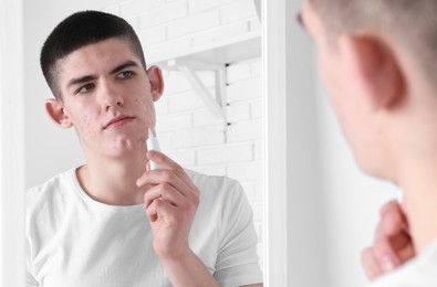 Young man with acne problem applying cosmetic product onto his skin near mirror indoors